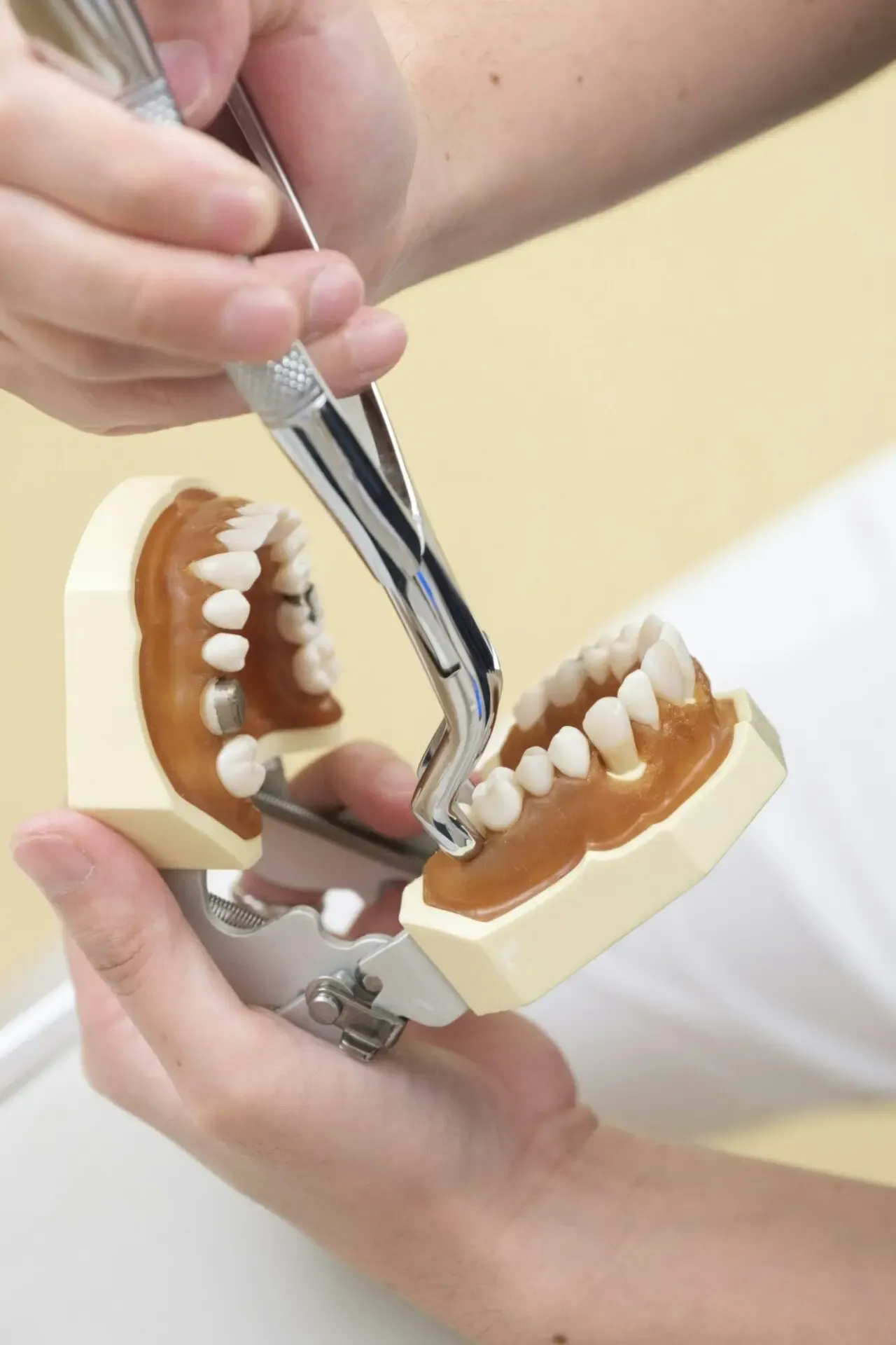 A tooth extraction at a dentist's office